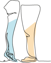 Kompressionstheraphie, Kompressionsstrümpfen I Homecare & Reha